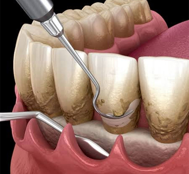Serivce Image